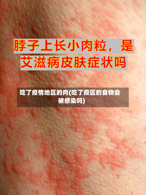 吃了疫情地区的肉(吃了疫区的食物会被感染吗)-第1张图片