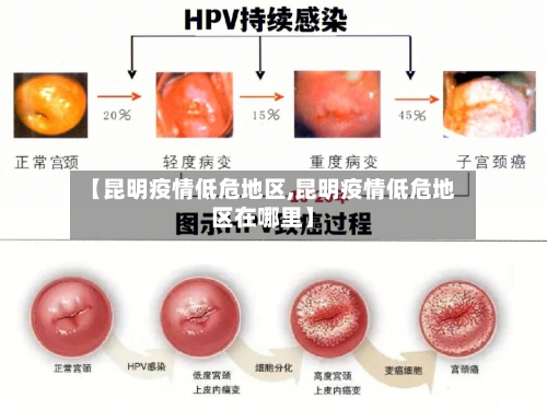 【昆明疫情低危地区,昆明疫情低危地区在哪里】-第1张图片