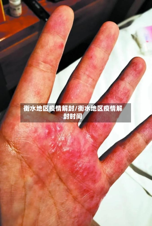 衡水地区疫情解封/衡水地区疫情解封时间-第1张图片